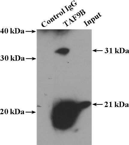 IP Result of anti-TAF9B (IP:Catalog No:115991, 4ug; Detection:Catalog No:115991 1:300) with HeLa cells lysate 4000ug.