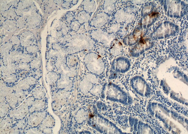 Immunohistochemistry of paraffin-embedded human stomach tissue slide using (GAST Antibody) at dilution of 1:1000 (under 10x lens).