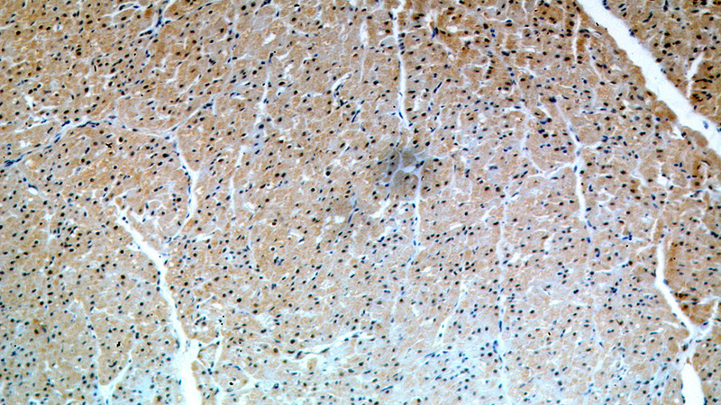 Immunohistochemical of paraffin-embedded human heart using Catalog No:108622(C19orf43 antibody) at dilution of 1:50 (under 10x lens)
