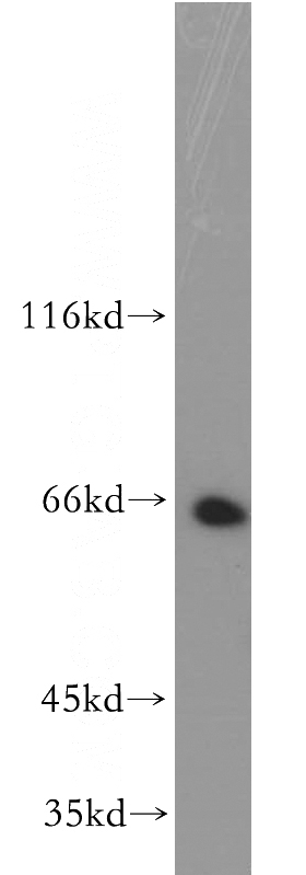 K-562 cells were subjected to SDS PAGE followed by western blot with Catalog No:109123(SPN antibody) at dilution of 1:500