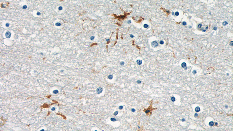 Immunohistochemistry of paraffin-embedded human brain tissue slide using Catalog No:112485(MAS1L Antibody) at dilution of 1:50 (under 40x lens)