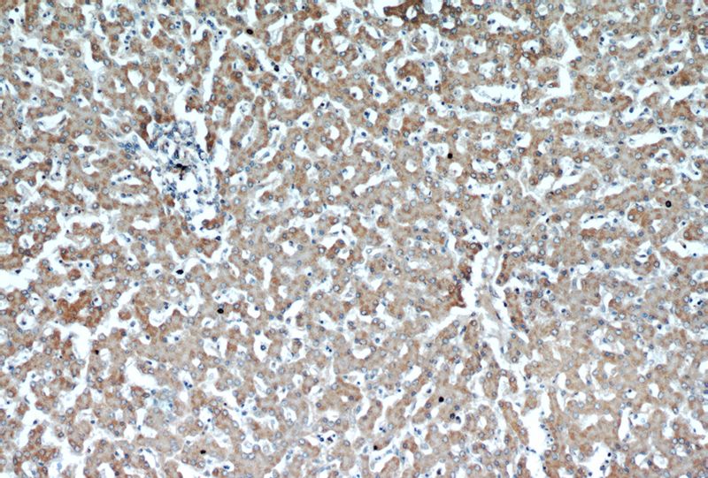 Immunohistochemical of paraffin-embedded human liver using Catalog No:115631(ST7 antibody) at dilution of 1:50 (under 10x lens)