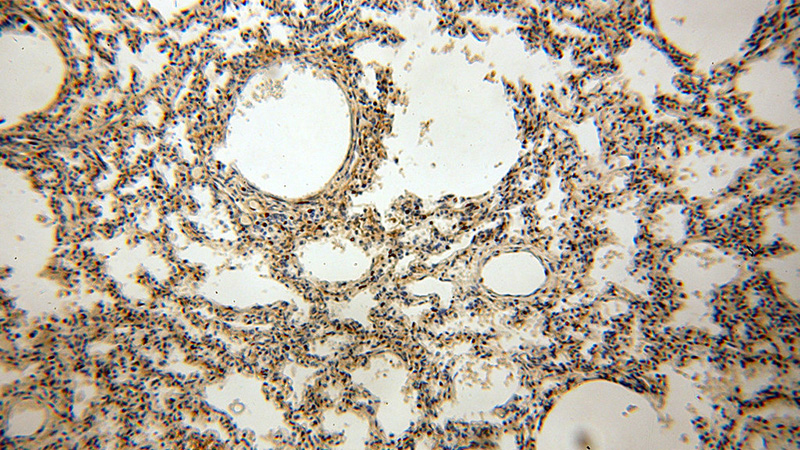 Immunohistochemical of paraffin-embedded human lung using Catalog No:107724(ACAP1 antibody) at dilution of 1:100 (under 10x lens)
