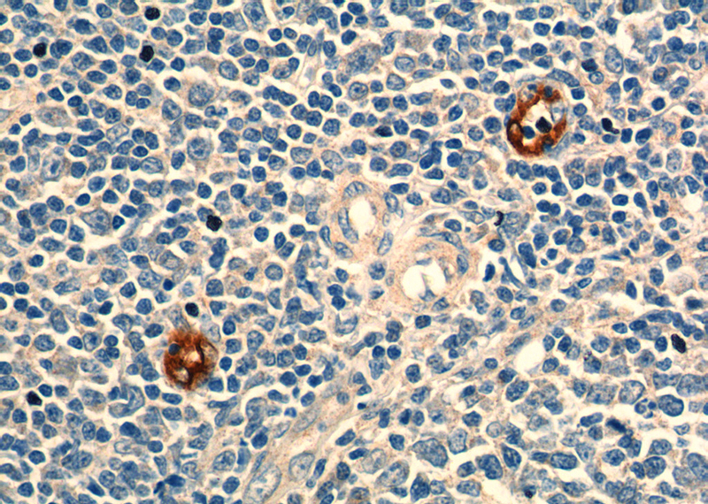 Immunohistochemistry of paraffin-embedded human tonsillitis tissue slide using Catalog No:112370(MADCAM1 Antibody) at dilution of 1:200 (under 40x lens).