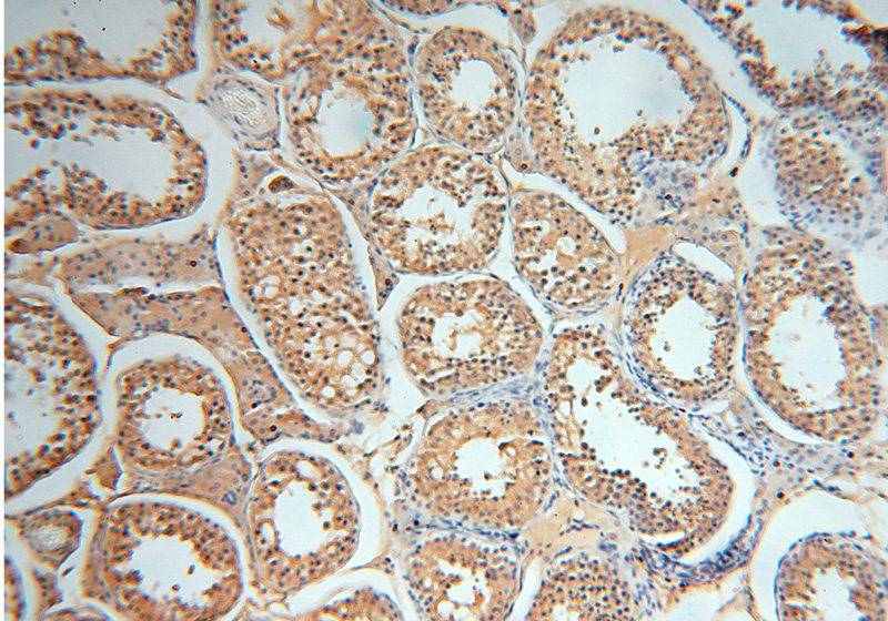 Immunohistochemical of paraffin-embedded human testis using Catalog No:107833(AGPAT6 antibody) at dilution of 1:100 (under 10x lens)