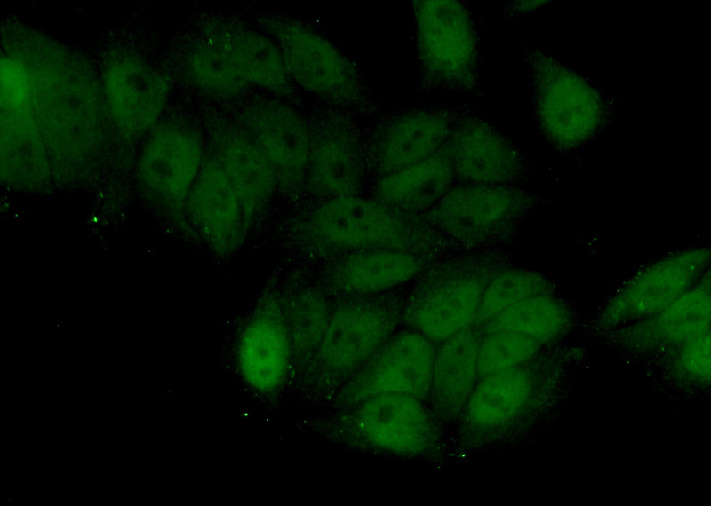 Immunofluorescent analysis of (10% Formaldehyde) fixed HeLa cells using Catalog No:117178(ZNF451 Antibody) at dilution of 1:50 and Alexa Fluor 488-congugated AffiniPure Goat Anti-Rabbit IgG(H+L)