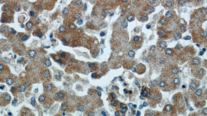 Immunohistochemical of paraffin-embedded human liver using Catalog No:115196(SERPINA10 antibody) at dilution of 1:100 (under 40x lens)