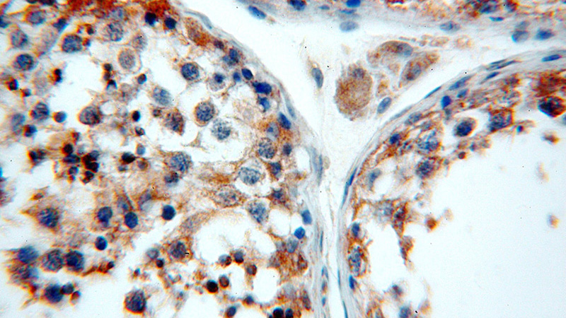 Immunohistochemical of paraffin-embedded human testis using Catalog No:112186(LDHC antibody) at dilution of 1:100 (under 40x lens)