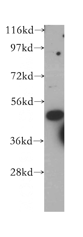 HeLa cells were subjected to SDS PAGE followed by western blot with Catalog No:116000(TFAP2C antibody) at dilution of 1:1000