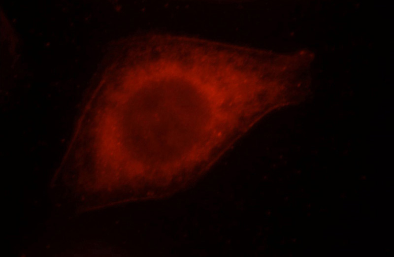 Immunofluorescent analysis of Hela cells, using ERC2 antibody Catalog No:110406 at 1:25 dilution and Rhodamine-labeled goat anti-rabbit IgG (red).