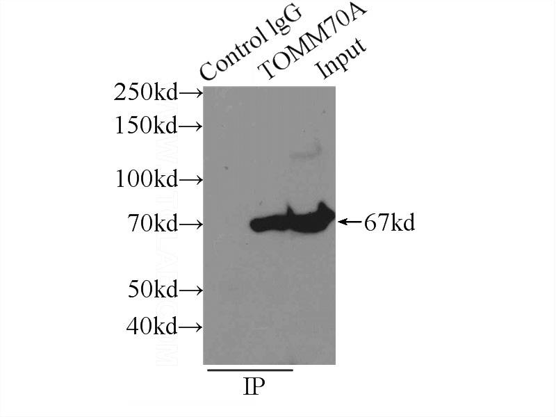 IP Result of anti-TOM70 (IP:Catalog No:116239, 3ug; Detection:Catalog No:116239 1:500) with mouse brain tissue lysate 6000ug.