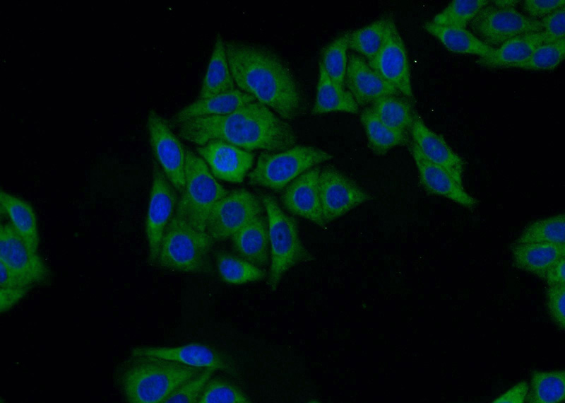 Immunofluorescent analysis of HepG2 cells using Catalog No:109768(DDA1 Antibody) at dilution of 1:25 and Alexa Fluor 488-congugated AffiniPure Goat Anti-Rabbit IgG(H+L)