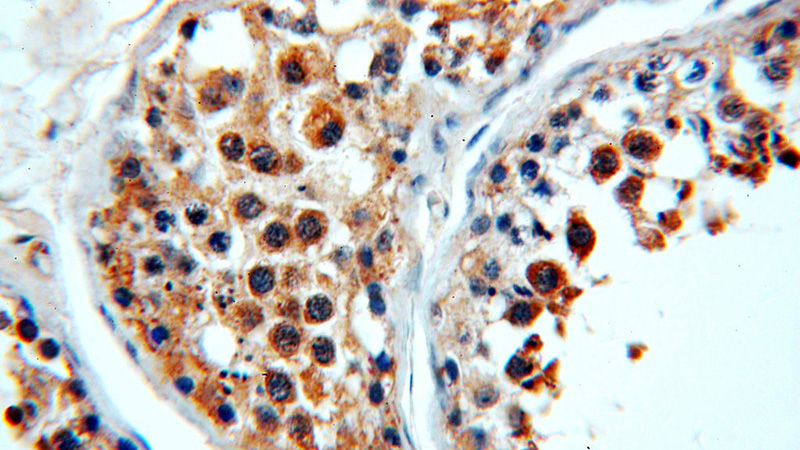 Immunohistochemical of paraffin-embedded human testis using Catalog No:116862(WDR32 antibody) at dilution of 1:100 (under 40x lens)