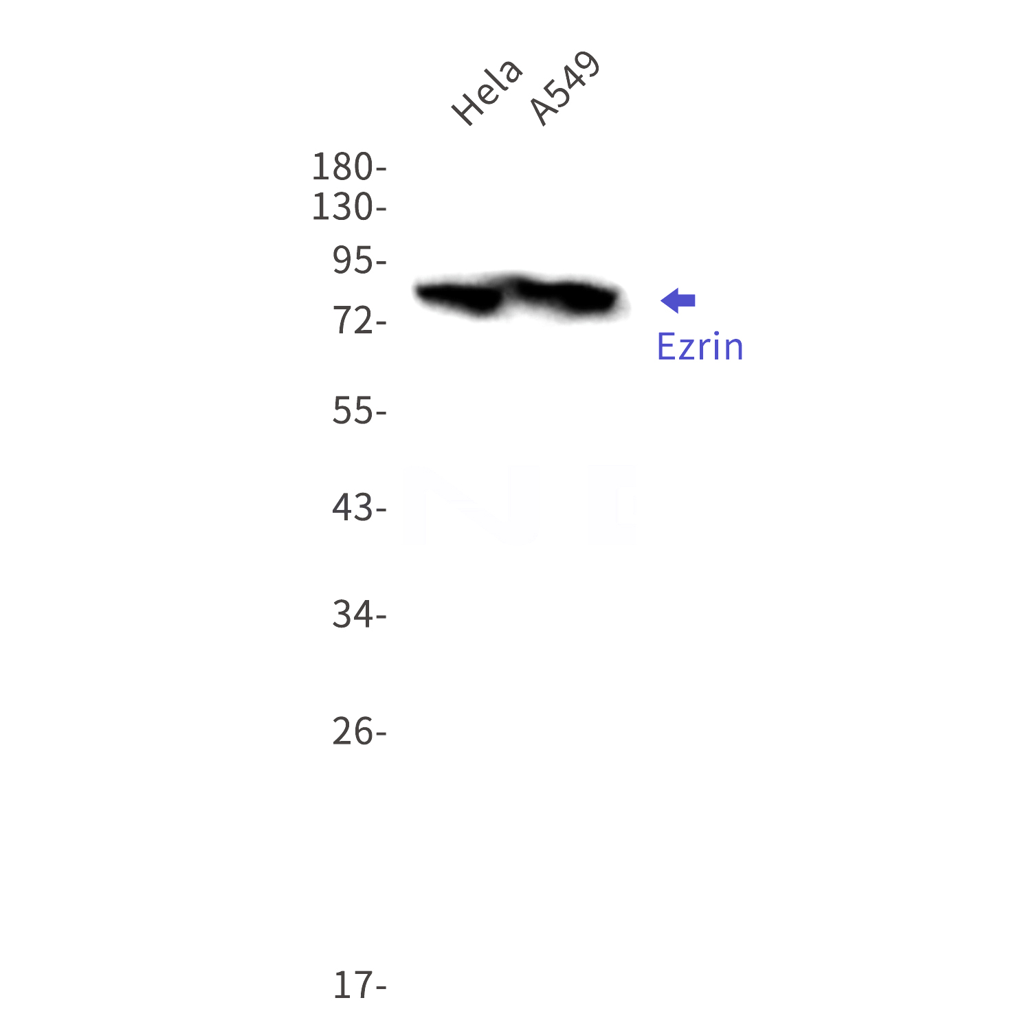 Western blot detection of Ezrin in Hela,A549 cell lysates using Ezrin Rabbit mAb(1:1000 diluted).Predicted band size:69kDa.Observed band size:80kDa.