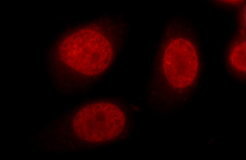 Immunofluorescent analysis of HeLa cells using Catalog No:110788(FUBP1 Antibody) at dilution of 1:25 and Rhodamine-Goat anti-Rabbit IgG