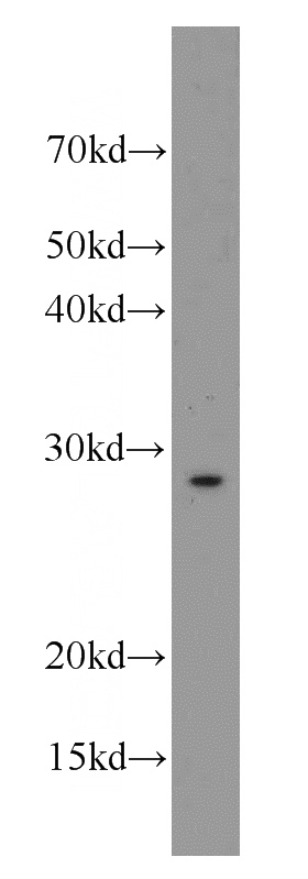 mouse heart tissue were subjected to SDS PAGE followed by western blot with Catalog No:115007(SCN4B antibody) at dilution of 1:500
