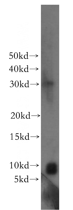 A549 cells were subjected to SDS PAGE followed by western blot with Catalog No:108987(CCDC72 antibody) at dilution of 1:500