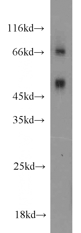 HeLa cells were subjected to SDS PAGE followed by western blot with Catalog No:112440(MAPKAPK2 antibody) at dilution of 1:1000