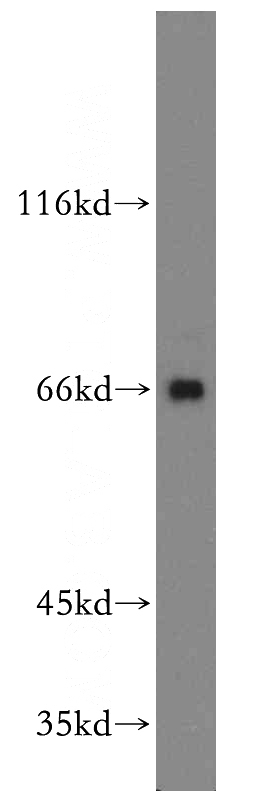 HEK-293 cells were subjected to SDS PAGE followed by western blot with Catalog No:108154(ARMCX2 antibody) at dilution of 1:1000