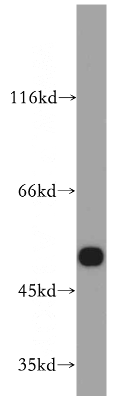 mouse brain tissue were subjected to SDS PAGE followed by western blot with Catalog No:110017(DRD5 antibody) at dilution of 1:500