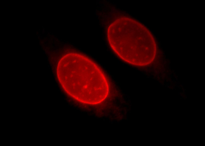 Immunofluorescent analysis of Hela cells, using EMD antibody Catalog No:110237 at 1:25 dilution and Rhodamine-labeled goat anti-rabbit IgG (red).
