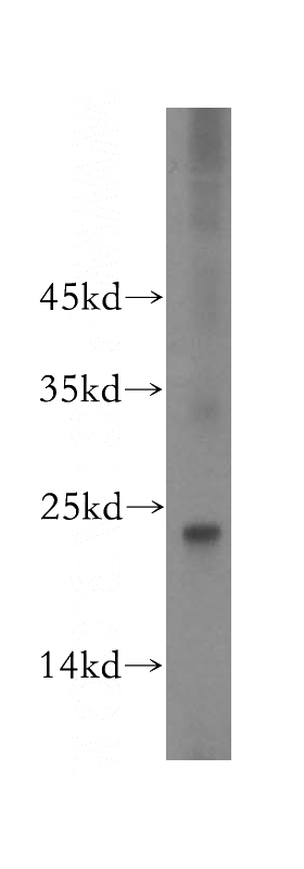 mouse large intestine tissue were subjected to SDS PAGE followed by western blot with Catalog No:111010(GNPNAT1 antibody) at dilution of 1:300