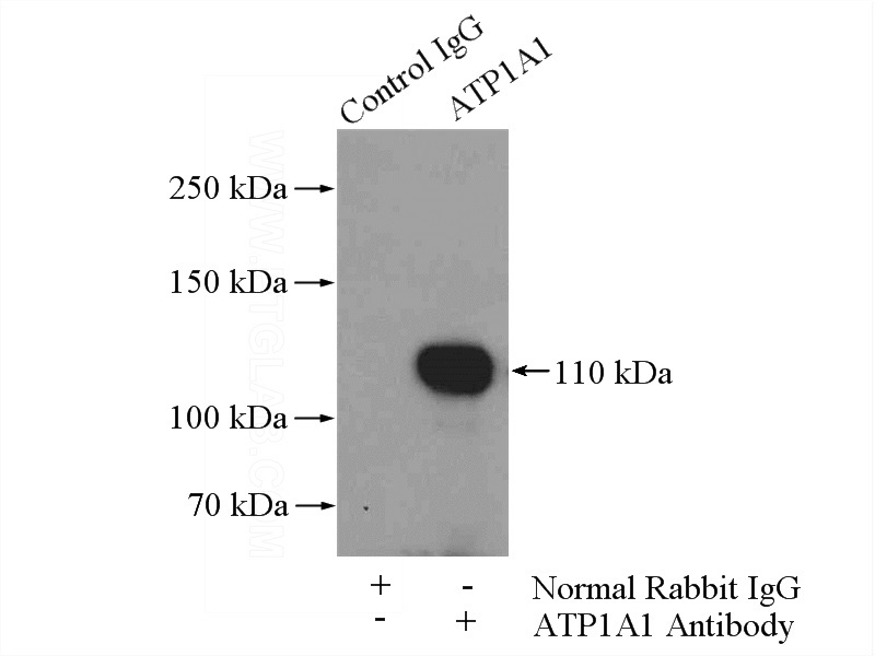 IP Result of anti-RAI14 (IP:Catalog No:114527, 4ug; Detection:Catalog No:114527 1:1000) with mouse testis tissue lysate 4000ug.