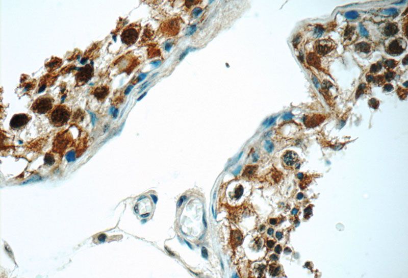 Immunohistochemistry of paraffin-embedded human testis tissue slide using Catalog No:114076(PP2A Antibody) at dilution of 1:50 (under 40x lens)