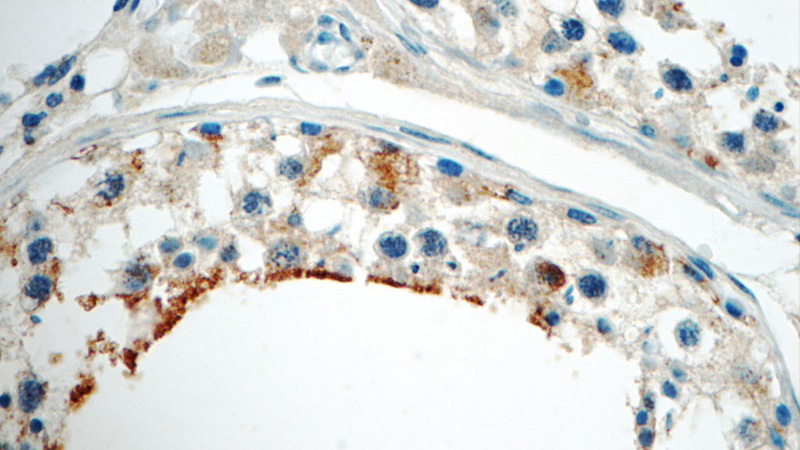 Immunohistochemistry of paraffin-embedded human testis tissue slide using Catalog No:117038(ZER1 Antibody) at dilution of 1:50 (under 40x lens)
