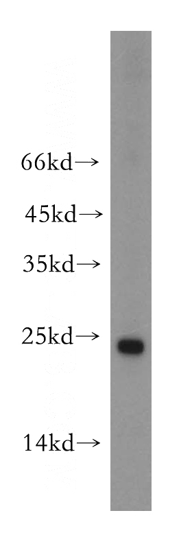 HepG2 cells were subjected to SDS PAGE followed by western blot with Catalog No:113067(NDUFAF2 antibody) at dilution of 1:800