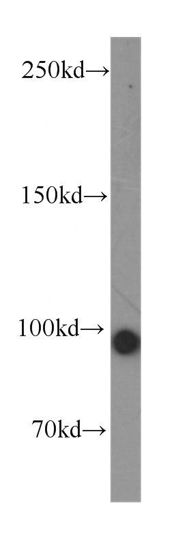 human testis tissue were subjected to SDS PAGE followed by western blot with Catalog No:107362(KIFAP3 antibody) at dilution of 1:1000