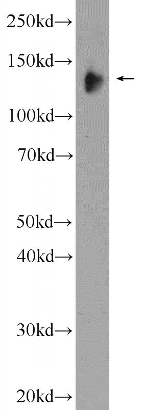 Jurkat cells were subjected to SDS PAGE followed by western blot with Catalog No:112045(KIAA0182 Antibody) at dilution of 1:600