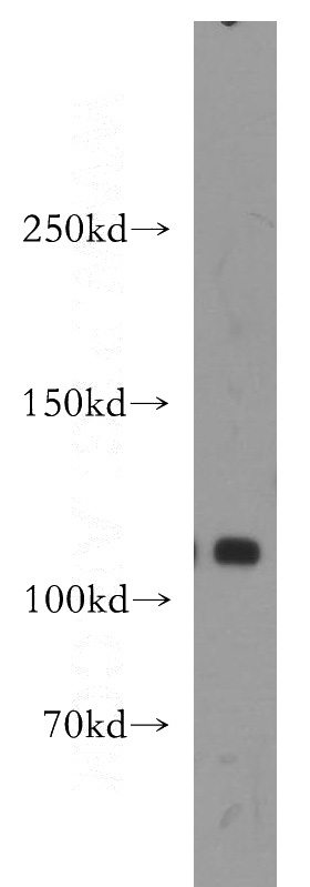HeLa cells were subjected to SDS PAGE followed by western blot with Catalog No:109946(DIS3 antibody) at dilution of 1:500