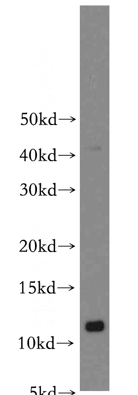 mouse lung tissue were subjected to SDS PAGE followed by western blot with Catalog No:114954(S100A10 antibody) at dilution of 1:1000