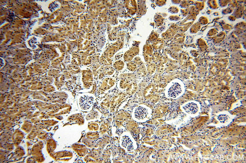 Immunohistochemical of paraffin-embedded human kidney using Catalog No:114364(PTK2B antibody) at dilution of 1:100 (under 10x lens)
