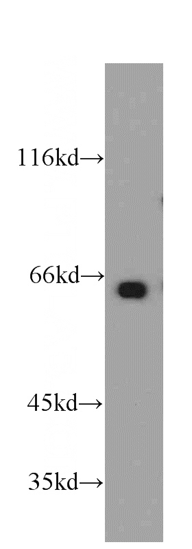 HeLa cells were subjected to SDS PAGE followed by western blot with Catalog No:112633(MEF2C antibody) at dilution of 1:500