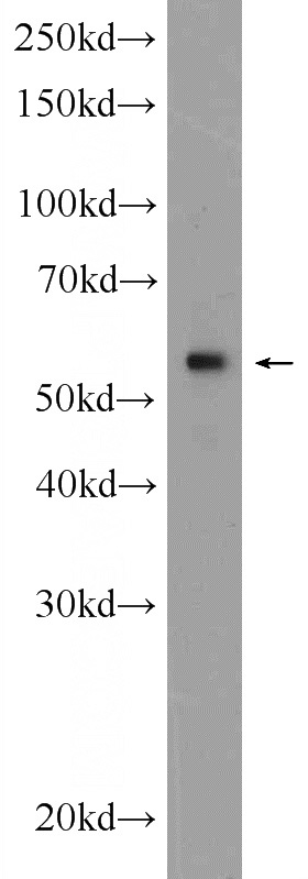 A549 cells were subjected to SDS PAGE followed by western blot with Catalog No:112114(KPNA4 Antibody) at dilution of 1:600