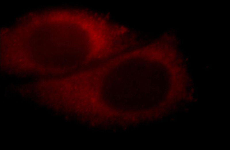 Immunofluorescent analysis of HepG2 cells, using ACTR10 antibody Catalog No:107714 at 1:25 dilution and Rhodamine-labeled goat anti-rabbit IgG (red).