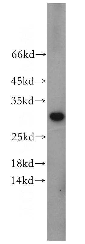 mouse testis tissue were subjected to SDS PAGE followed by western blot with Catalog No:109236(CHMP6 antibody) at dilution of 1:400