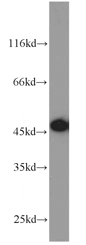 Jurkat cells were subjected to SDS PAGE followed by western blot with Catalog No:113416(ORAI1 antibody) at dilution of 1:800