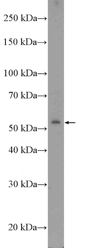 COLO 320 cells were subjected to SDS PAGE followed by western blot with Catalog No:117183(ZNF486 Antibody) at dilution of 1:600