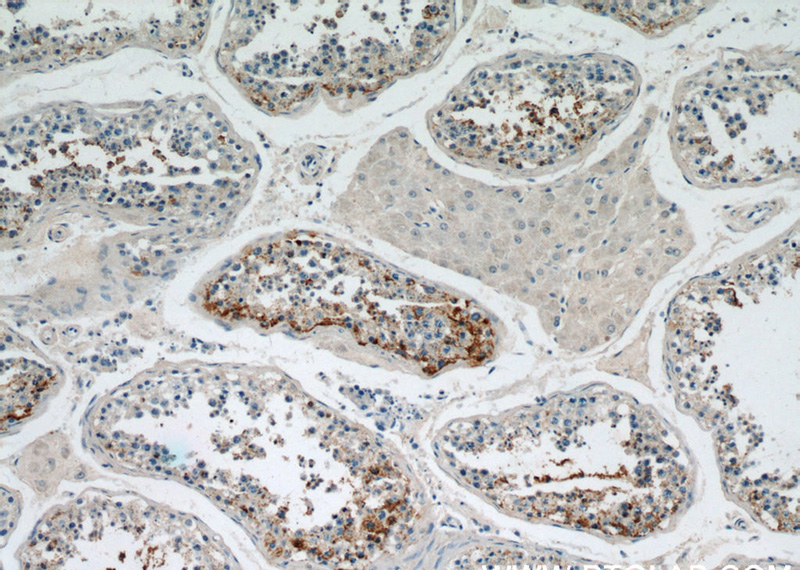 Immunohistochemical of paraffin-embedded human testis using Catalog No:115640(SPPL2A antibody) at dilution of 1:50 (under 10x lens)