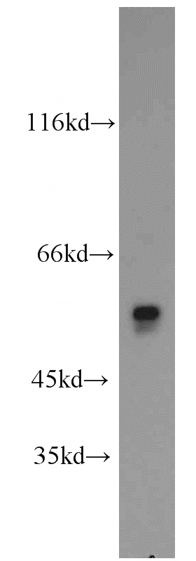 mouse testis tissue were subjected to SDS PAGE followed by western blot with Catalog No:113525(OXCT2 antibody) at dilution of 1:2000