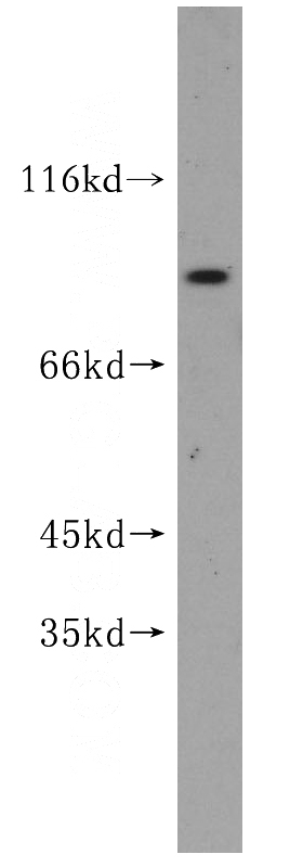 human brain tissue were subjected to SDS PAGE followed by western blot with Catalog No:111673(IFT81 antibody) at dilution of 1:600