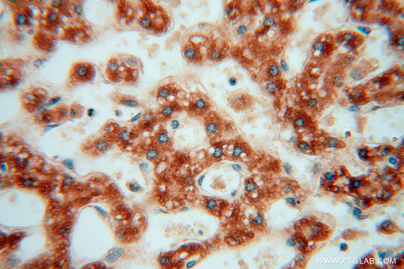 Immunohistochemical of paraffin-embedded human liver using Catalog No:113467(ocIAD1 antibody) at dilution of 1:100 (under 40x lens)