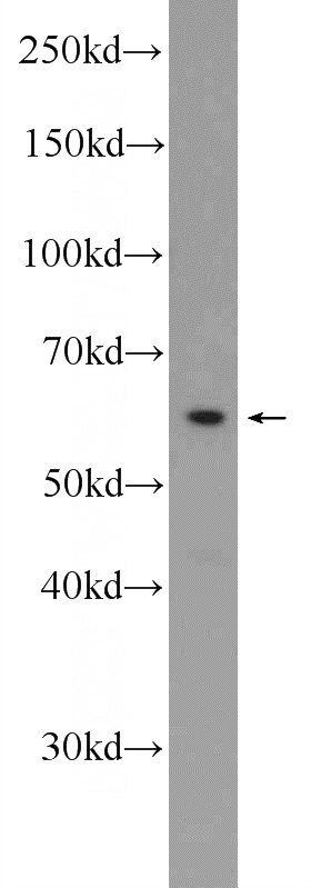 PC-3 cells were subjected to SDS PAGE followed by western blot with Catalog No:117270(ZWILCH Antibody) at dilution of 1:500