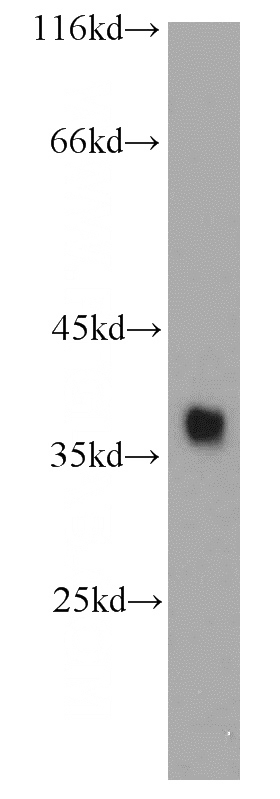 MCF7 cells were subjected to SDS PAGE followed by western blot with Catalog No:114625(RFC4 antibody) at dilution of 1:500