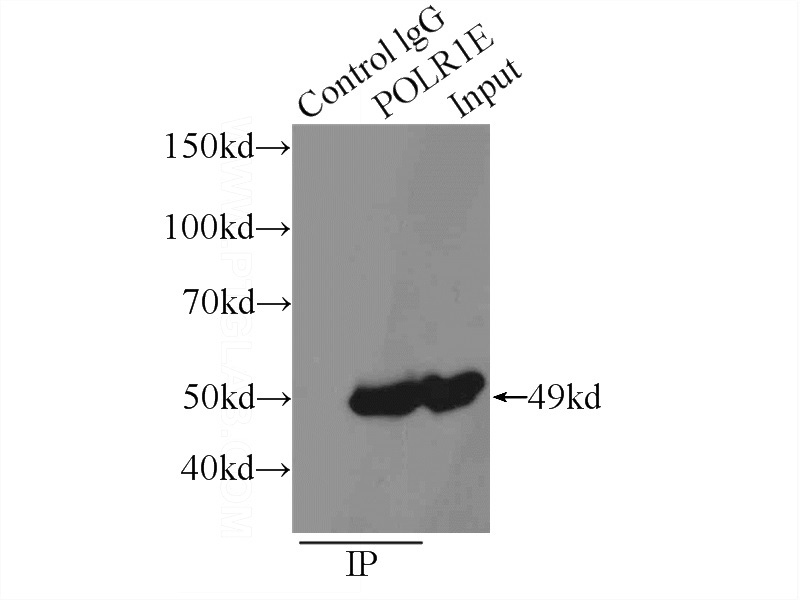 IP Result of anti-POLR1E (IP:Catalog No:114038, 3ug; Detection:Catalog No:114038 1:500) with Jurkat cells lysate 1000ug.