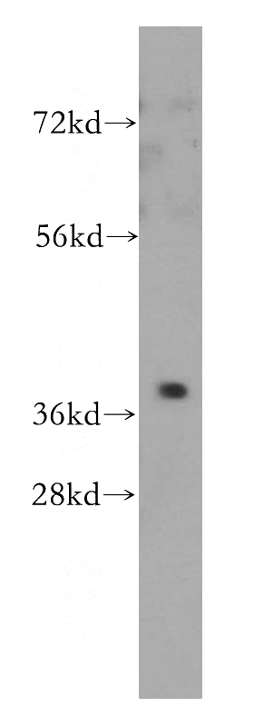 mouse kidney tissue were subjected to SDS PAGE followed by western blot with Catalog No:114273(PTGR2 antibody) at dilution of 1:500