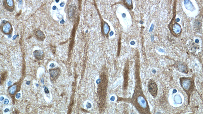 Immunohistochemistry of paraffin-embedded human brain tissue slide using Catalog No:117308(Tubulin-beta Antibody) at dilution of 1:400 (under 40x lens)